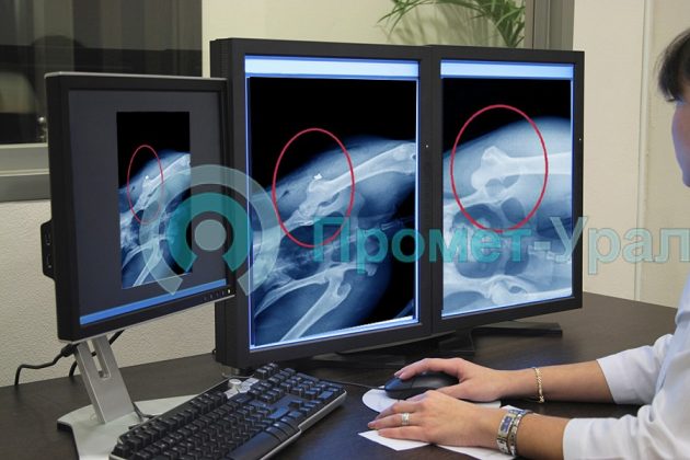 Цифровой рентген: что это такое, плюсы проведения